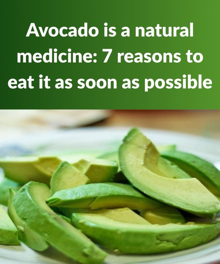7 Reasons to Eat Avocado