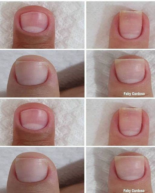 Apple cider vinegar tip for strengthening and growing nails