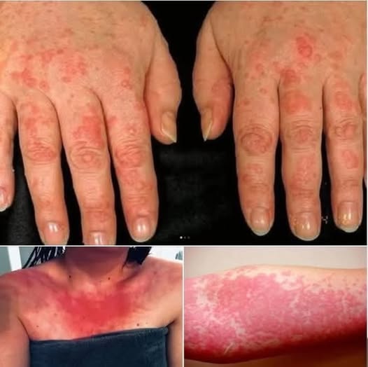 These are the consequences of sleeping with the…