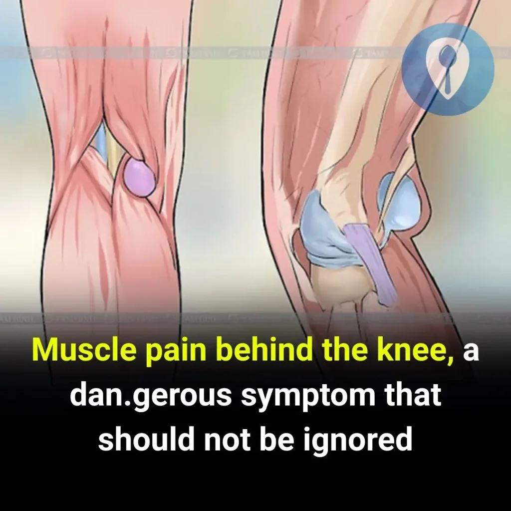 Muscle Pain Behind the Knee: A Dangerous Symptom That Should Not Be Ignored