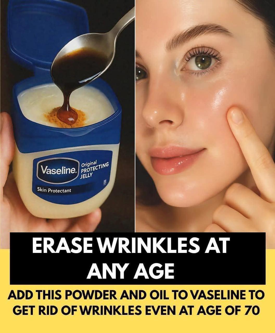 Magic Vaseline Anti-Wrinkle Recipe – Erase Wrinkles at Any Age, Even After 70!
