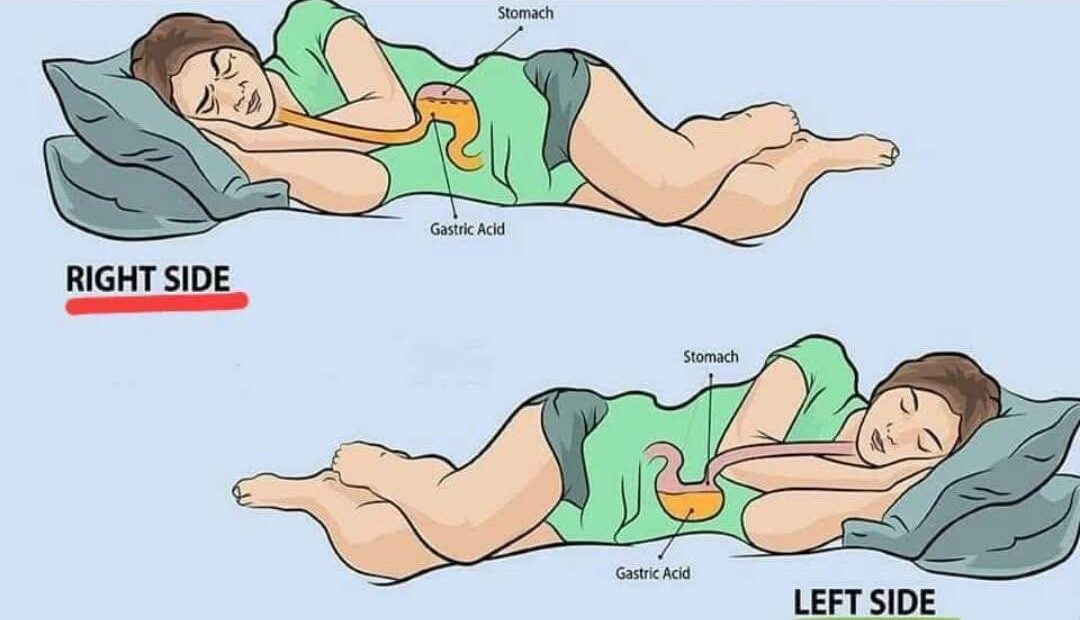 Is Left-Side Sleeping the Secret to Better Health?