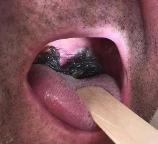 Here are the consequences of sleeping with…