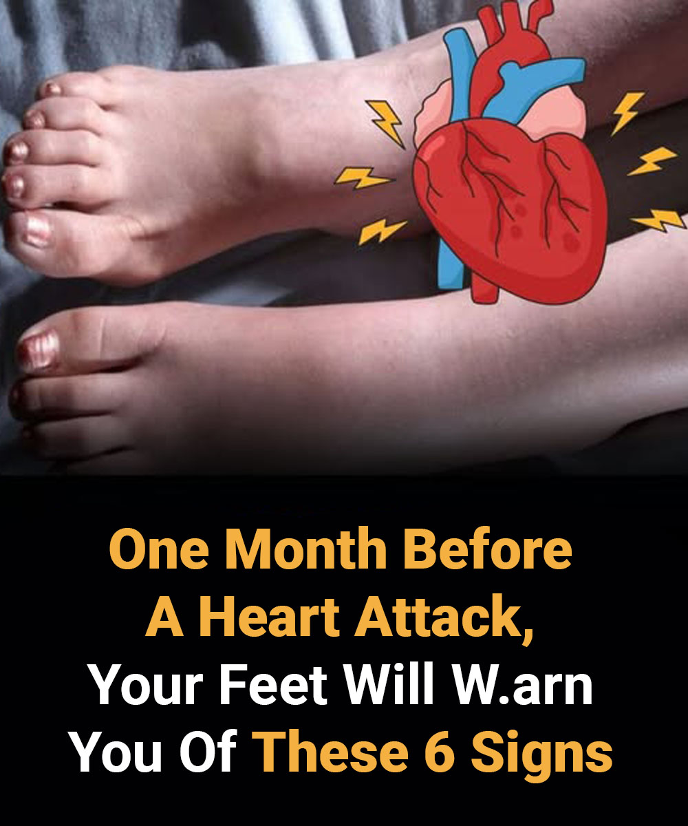 6 Silent Signs in Your Feet That Could Warn of a Heart Attack Weeks in Advance
