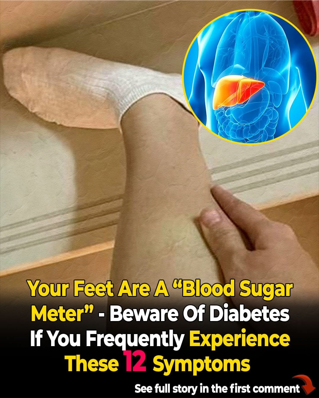 Your Feet Are a “Blood Sugar Meter” – Beware of Diabetes If You Frequently Experience These 12 Symptoms