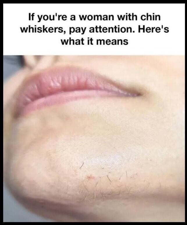 The Science of Chin Hair: Why It Grows and How to Manage It