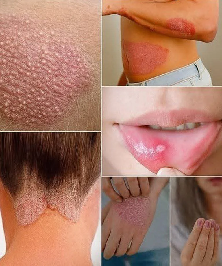 Signs you should know if you have this thing called da..