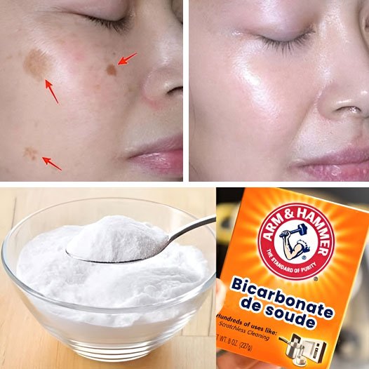 4 Ways to Erase Age Spots with Baking Soda for Younger, More Even Skin