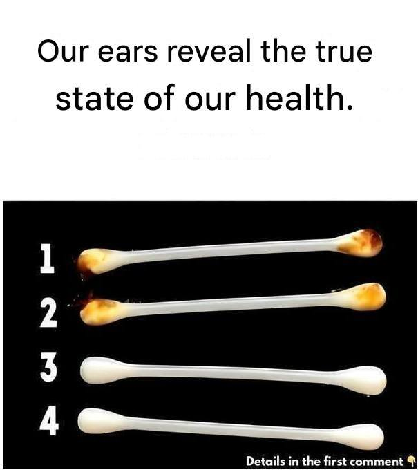 Our Ears Reveal the True State of Our Health — Here’s What to Look For