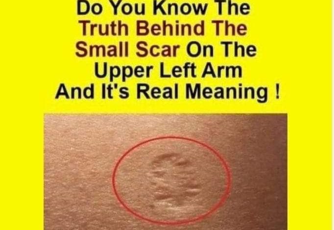 Do you know the true meaning of the little scar?